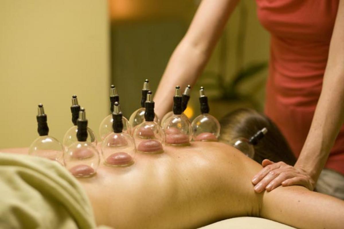 Cupping Therapy’ gains popularity among NRIs
